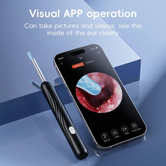 Smart Ear Wax Removal Device with HD Camera